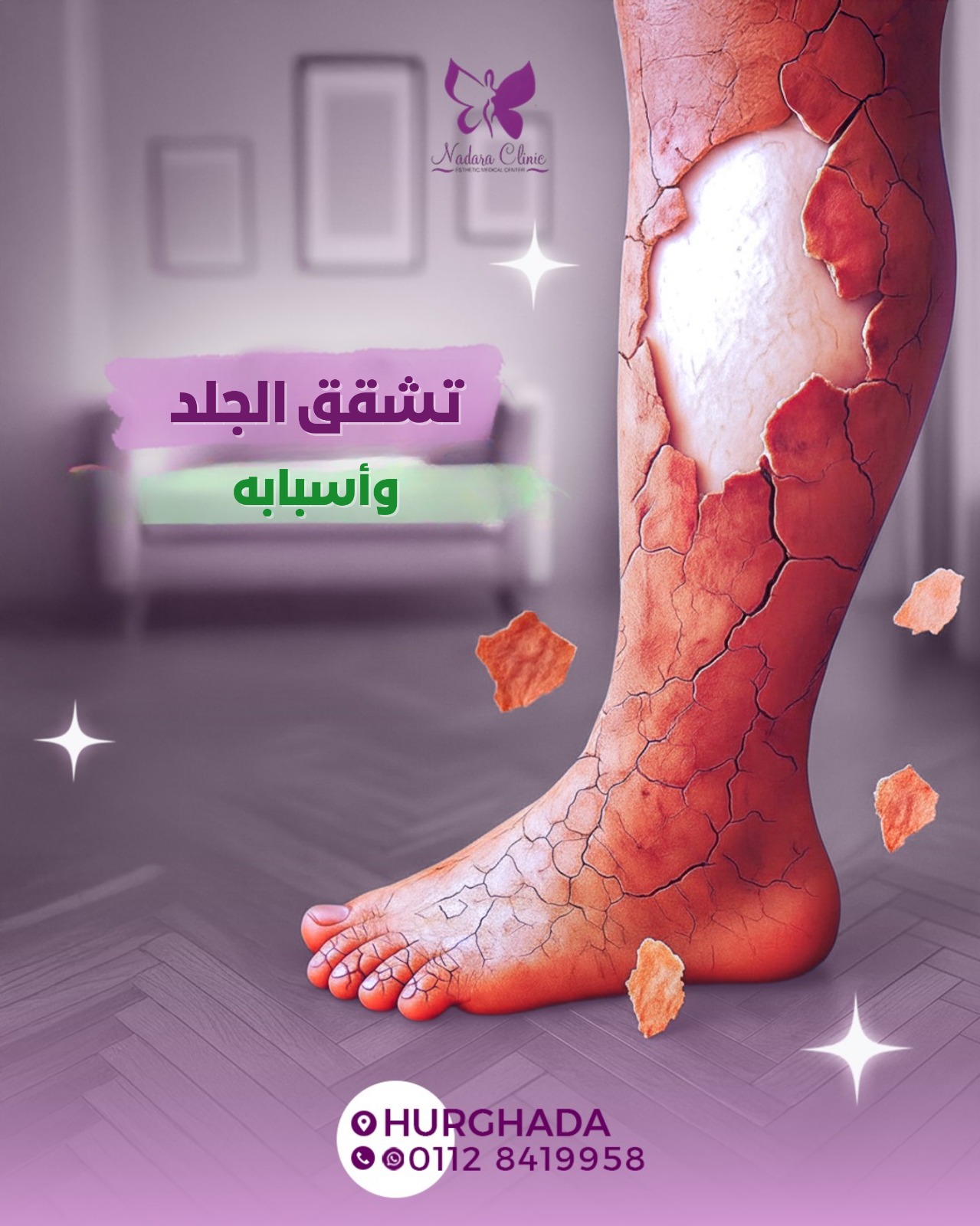 تشقق الجلد وأسبابه في الغردقة